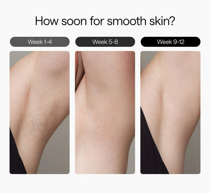 Sapphire Ice Cooling IPL Hair Removal Device